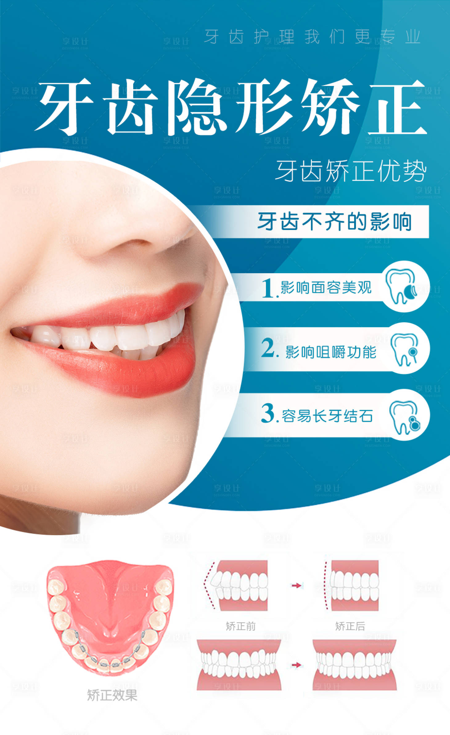 【源文件下载】 海报 医美 牙科 牙齿 矫正 隐形 美观 微笑